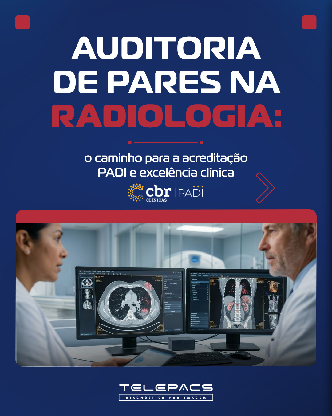 A busca incessante por qualidade na radiologia não é apenas uma tendência; é uma necessidade vital para a segurança do paciente e a reputação das instituições de saúde. A Auditoria de Pares, ou Peer Review, se destaca como uma ferramenta essencial nesse cenário, promovendo melhorias contínuas e garantindo a consistência diagnóstica.
Sabia que esse processo não é uma forma de punição, mas sim um incentivo ao aprendizado e à excelência? Ao implementar práticas de revisão sistemática, sua clínica não apenas se prepara para acreditações como o PADI, mas também fortalece a confiança no diagnóstico.
Acesse nosso Blog (link na bio) e saiba mais!
📲 (34) 99939-2205
🌐 telepacs.com.br
#Radiologia #Qualidade #PeerReview #Saúde #Acreditação #Telepacs